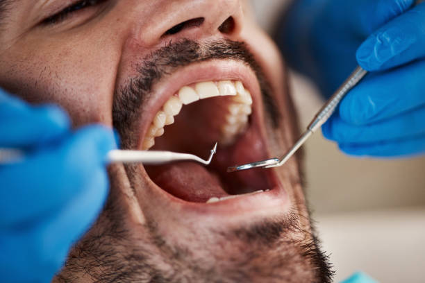 Best Emergency Care for Gum Disease in Watauga, TX