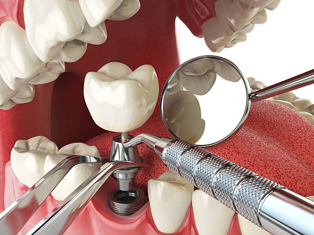 Trusted TX Emergency Dental Service Experts