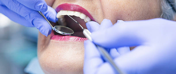 Best Emergency Wisdom Tooth Extraction in Watauga, TX